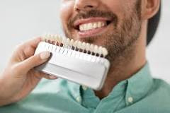 Teeth whitning